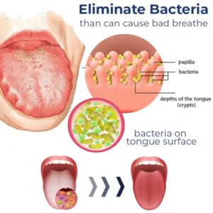 Canada Bioluma™ White Hairy Tongue Removal Kit