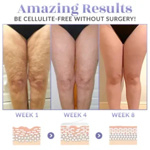 SKINNIER Tightening & Cellulite-Reducing Thigh Patch