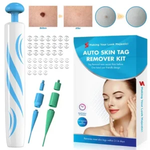 Skin Tag Removal Kit