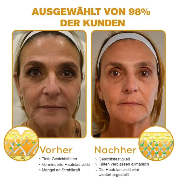 𝐒𝐩𝐳𝐯™ Botox Bienenvenom Faltenentfernungscreme