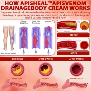 ApisHeal™ ApisVenom EdemaSupport Lymphatic Detox Cream