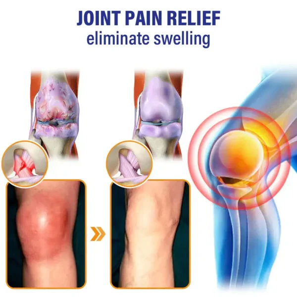 ArthroCareX™ Lidocaine Joints Pain Relief Healing Liquid