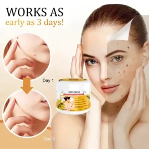 Fivfivgo™ Bee Venom Mole and Wart Treatment Cream