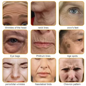 Flysmus™ Collagen Peptides Wrinkle Removal Cream