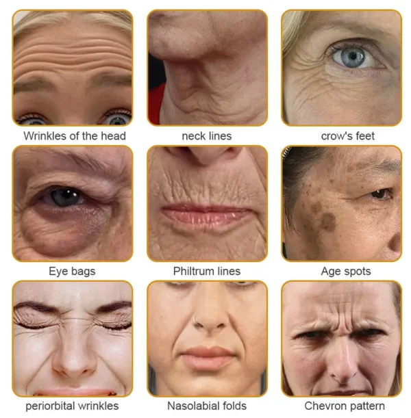 Flysmus™ Collagen Peptides Wrinkle Removal Cream