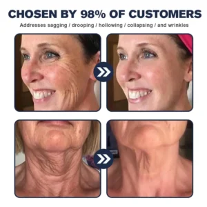 Flysmus™ Collagen Peptides Wrinkle Removal Cream